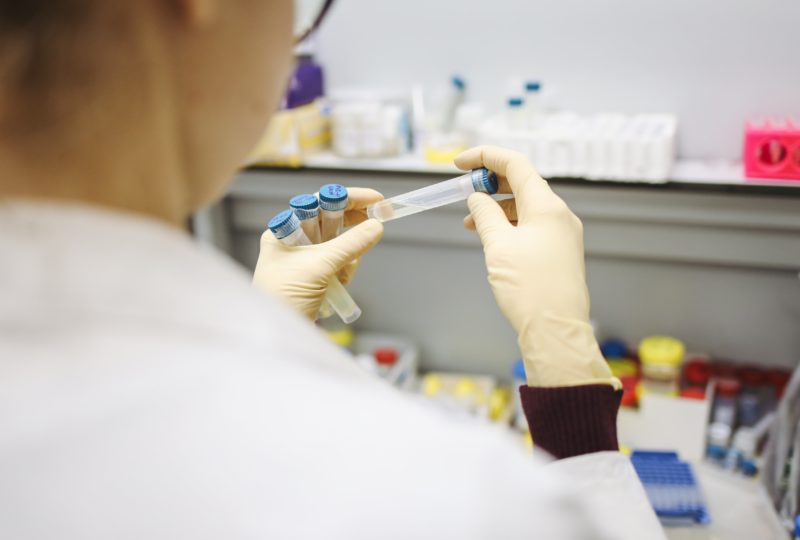 Does CBD Show Up in Drug Tests?